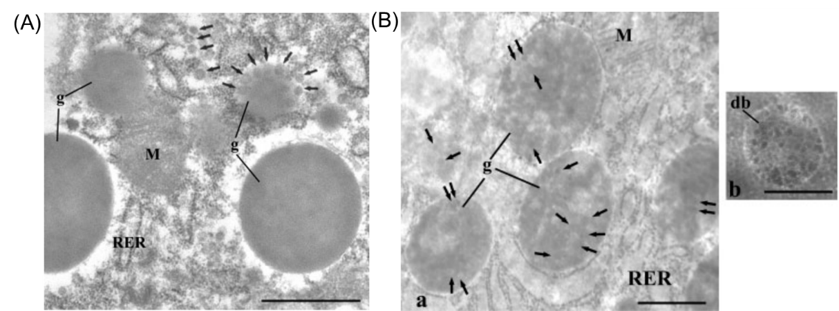 ZT推荐|低压透射电子显微镜LVEM在病毒学研究中的应用